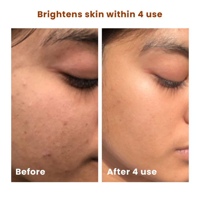 Salicylic Acid BHA Brightening Scrub - The Skin Story - Scrub